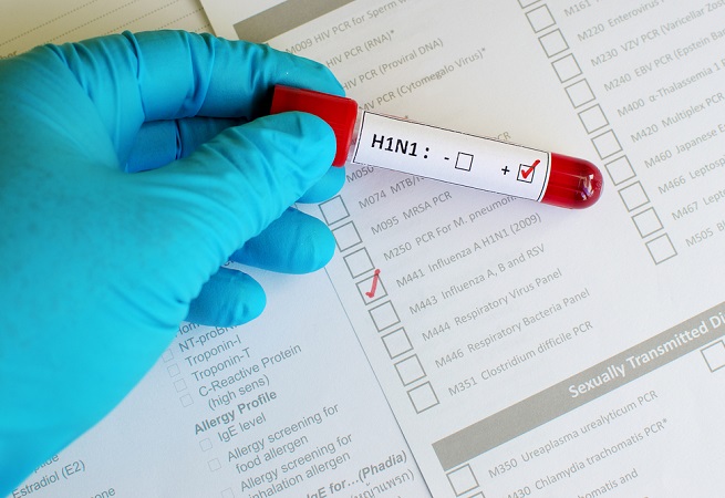 Núcleo de Saúde identifica morte de idoso por H1N1 em Serrinha