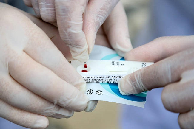 Anvisa aprova venda de testes rápidos para covid-19 em farmácias