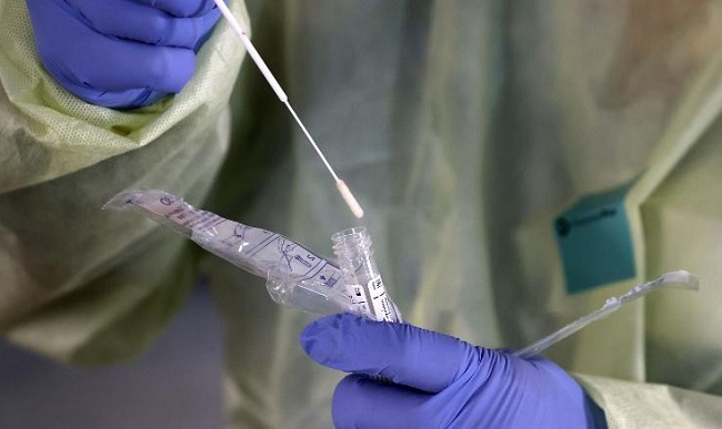 Cientistas brasileiros criam teste rápido que detecta coronavírus na saliva