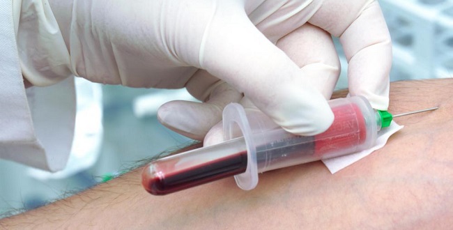 Novo exame de sangue é capaz de detectar 5 tipos de câncer de forma precoce