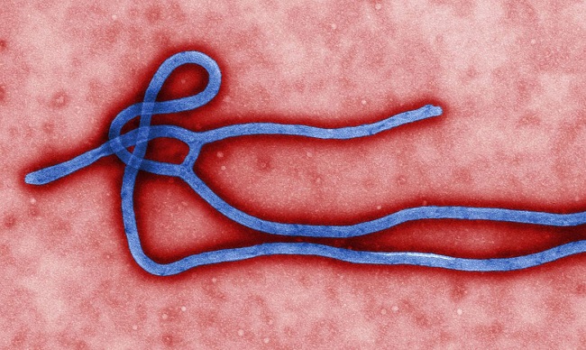 África: Guiné declara novo surto de ebola